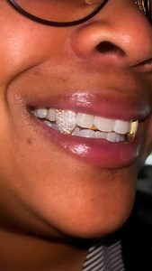 10kt yellow gold Extended Fangs VVS set ☀️☀️ 🎄WINTER SHOPPING PROMOTION: AGO15 promotion code for 15% off valid on AGORADIANT.COM 🎄 ✅monthly payments available 💎Diamond tester certified #grillz #grills #customgrillz #gold #silver #hiphop #hiphopculture #moissanitejewelry #accessories #jewelry #jewellry #diamondgrillz | Agoradiant