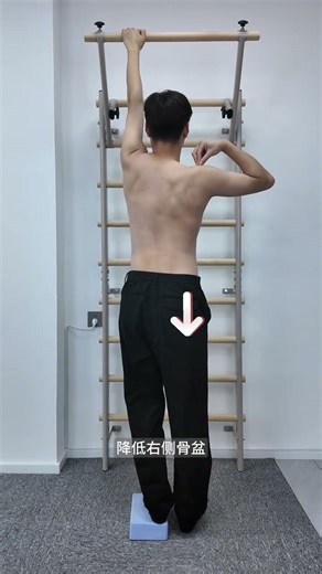 S-curve spine chest and right protrusion low left shoulder left protrusion of waist an