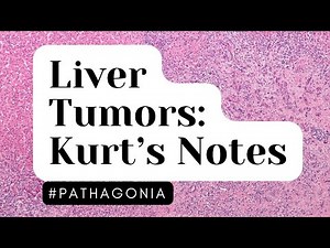 Liver Tumors: Kurt’s Notes #pathagonia