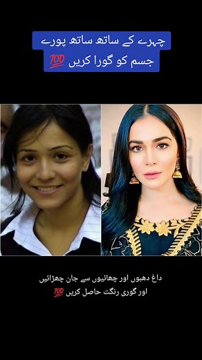 Part 1 | Get High Level Beautiful Skin 🤗 #skincare #skintone #whitening #bodywhitening #antiacne #medicated #dermatology #pharmacist #glutawhitetablets #makeuptutorial