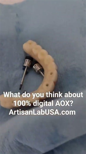 🚀 100% Digital All on X Same Day Loading 🚀 Say goodbye to analog limitations!