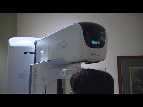 3D Mammograms