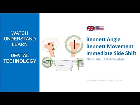BENNETT | Movement - Angle - Immediate Side Shift
