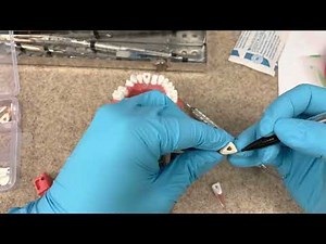 How to pass the CDCA ADEX Dental Exam Part 2 Endo