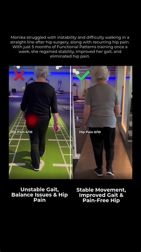Functional Patterns Evidence Based Practice on Instagram: "Instability to Confident Movement In March 2023, Monika began her Functional Patterns journey after struggling with balance issues and worsening gait mechanics following hip surgery. By July 2023, she had restored her ability to move in a straight line, improved her gait cycle, and felt more stable and confident—all without hip pain. Before (March 2023): ❌ Feeling unstable ❌ Unable to walk a straight line ❌ Occasional hip pain 4/10 After