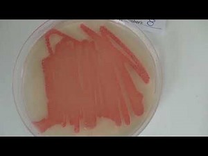 Simulation of an EPIDEMIC Results & Instructions