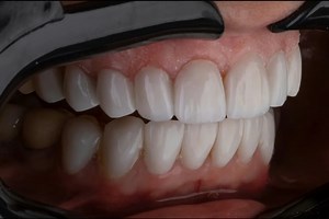 Teeth hurt? It could be because of a 500-million-year-old fish | ABS-CBN News