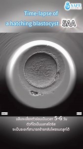 Time-lapse of a hatching blastocyst (5AA) #SafeFertilityGroup #มีบุตรยาก #ศูนย์รักษาผู้มีบุตรยาก #เด็กหลอดแก้ว #IVF #ICSI #IUI #Egg freezing #ฝากไข่ #IVFClinicThailand | Safe Fertility Group