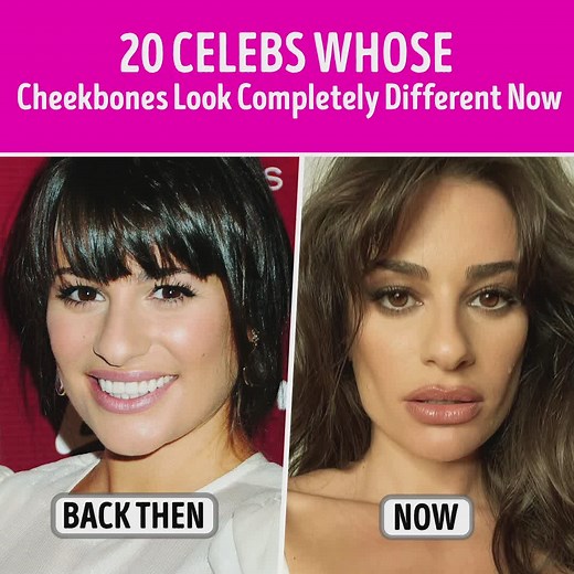 91K views · 406 reactions | 20 Celebs Whose Cheekbones Look Completely Different Now | CelebRatings | Facebook