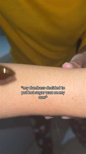 Hot Sugar Waxing: What You Need to Know