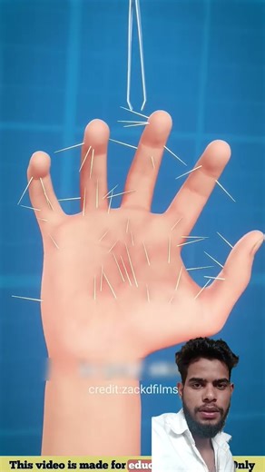 How To Remove Cactus Thorns 🤔😨 || #shorts​ #cactus​ #thornremoval​ #3danimation