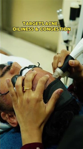 Chemical Peel Treatment for Acne | SkinMD Expert Care