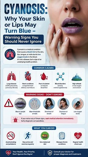 💙 Cyanosis: The Blue Warning Your Body Should Never Ignore