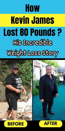 Weight Loss Journey of Kevin James: How He Shed 80 Pounds? - Health Blog