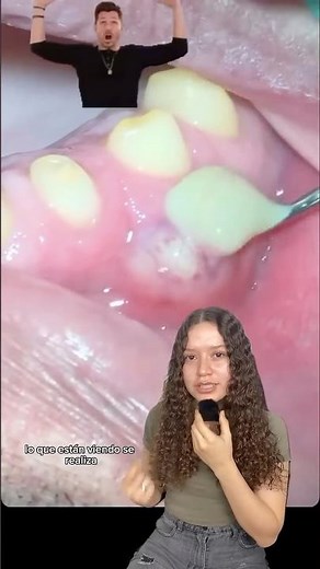 Mouth abscesses 🦠⚠️ #dentistry #dentist #teeth #dentistrywithcri