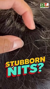 Tried everything but Lice & Nits keep coming back? 😩 One wash with this — problem solved! ✅ Moms across India trust our Tea Tree Anti-Lice Shampoo for a reason — it works in just ONE wash! 💥 🌿 100% Natural & Safe for Kids (3 ) 🧴 Instantly removes lice, nits & eggs 🎁 Comes with FREE lice removal comb 📦 24–48 hour delivery based on your pincode 💚 No more itching. No more shame. Just clean, healthy hair. 🛒 Order now on Amazon, Flipkart, Nykaa, Meesho & our website | Botanical Luxuriate ️