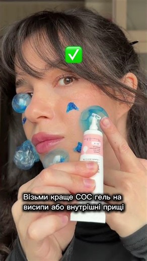 Давиш прищі?? SOS spot від прищів за пром0 liza 10% на ‪@recare.formulations‬ #прищі #висипи