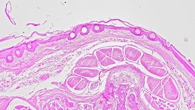 Cross Section of Rat Tail Filmed Under Microscope 100x Against Bright Field Background Stock Video - Video of pest, digger: 262513979