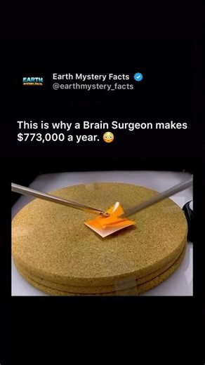 Brain Surgeon Earns $773,000 a Year! 🧠💰 The Power of Neurosurgery Tools Explained | #brainsurgery