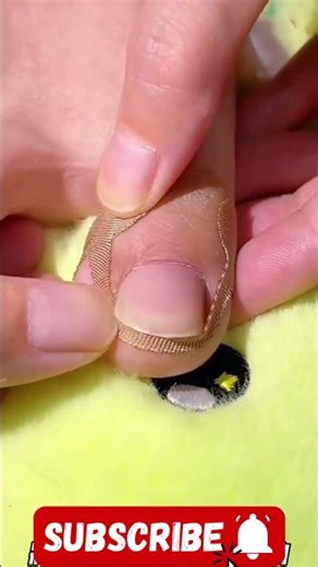 Product Link in Bio (#429 ) ✅Toe Align Ingrown Nail Corrector Stickers #shorts