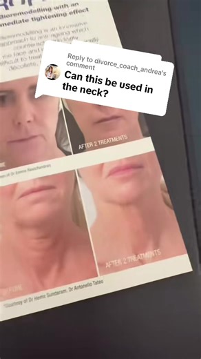 Understanding Profhilo and Skin Boosters for Neck Treatments