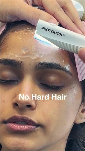 Facial Waxing vs Dermaplaning Before Wedding | Best Pre Bridal Facial Hair Removal for Brides