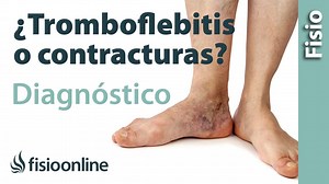 Diagnóstico diferencial de la tromboflebitis. ¿Cómo saber si es se trata solo de un dolor muscular?