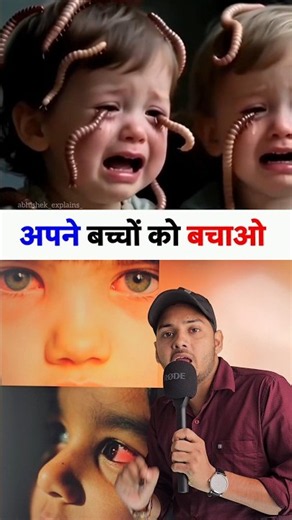 Save your children 😱 #facts #information #children #eyes #shorts