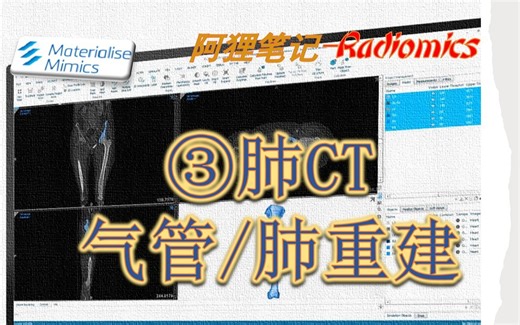 mimics-气管肺重建及分割