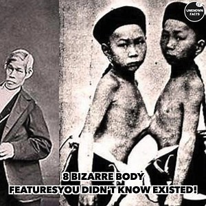 8 Bizarre Body Features You Didn’t Know Existed