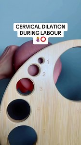 Cervical Dilation #midwifeengineer #PregnancyJourney #trending Video: Rescue Midwife . I own no rights to the song playing | Midwife Engineer