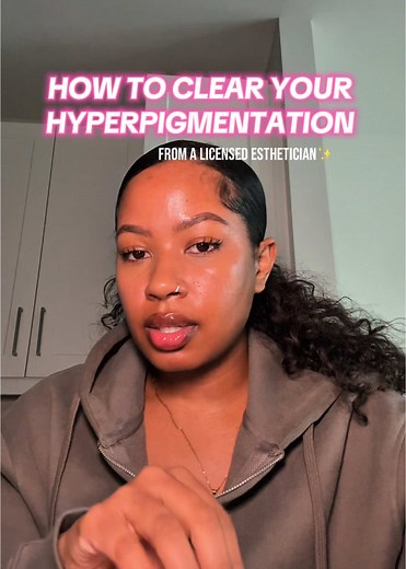 Effective Hyperpigmentation Treatment: 3-Step Guide