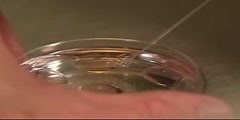In vitro fertilization