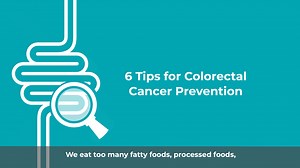 12 reactions | Colon cancer is preventable, says Dr. Ignacio Castellon, chief of radiation oncology at #MemorialCancerInstitute. Here are 6 prevention tips that could help save your life. Learn more at https://www.MHS.net/Colon. | Memorial Healthcare System | Facebook