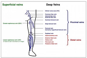 Inferior vena cava (IVC) - SlideServe