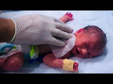 “Why Is This Beautiful Baby Suddenly Crying Loudly? 👶😢 | Emotional NICU Moment 💞”