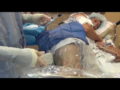 Peripheral Nerve Block Postoperative Care