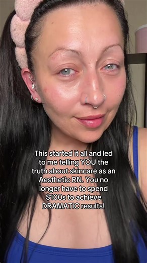 Achieve Youthful Skin with Affordable Skincare Secrets