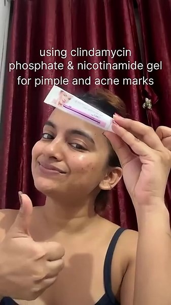 1 month using clindamycin phosphate & Nicotinamide Gel #pimple #acne #acnegel clinsol gel #skincare