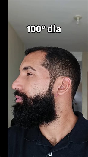 100 days of beard growth.