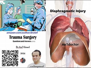 Diaphragmatic Injury A Comprehensive Guide for Medical Profes...