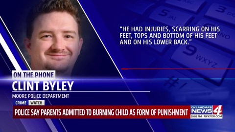 Police say parents admitted to burning child as form of punishment