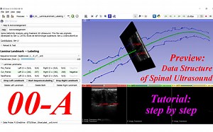 Lamina Landmark Labeling. #00-A. Preview -- data structure of spinal ultrasound
