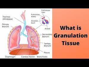 What is Granulation Tissue