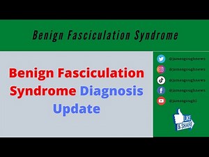 Benign Fasciculation Syndrome Diagnosis Update
