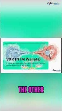 VXR: The Secret to Spotting Real Market Moves! #shorts