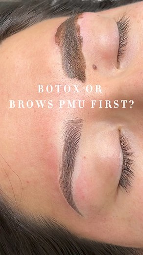 1.6K views · 15 reactions | BOTOX OR BROWS PMU PROCEDURE FIRST? | Be Brows | Facebook