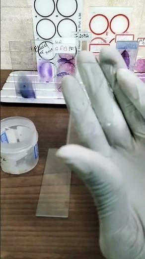 Sputum for Afb staining#shorts