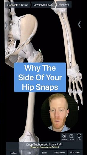 Why Your Hip Snaps Or “Dislocates” (External Snapping Hip Syndrome) #snappinghip #hippain