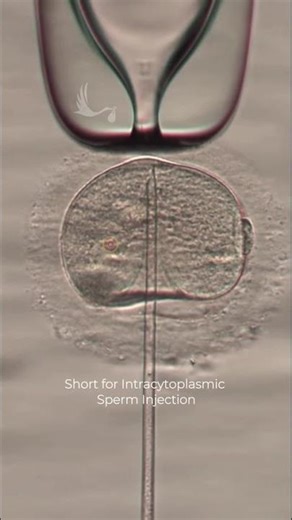 Test tube baby || In vitro fertilization || amezing science